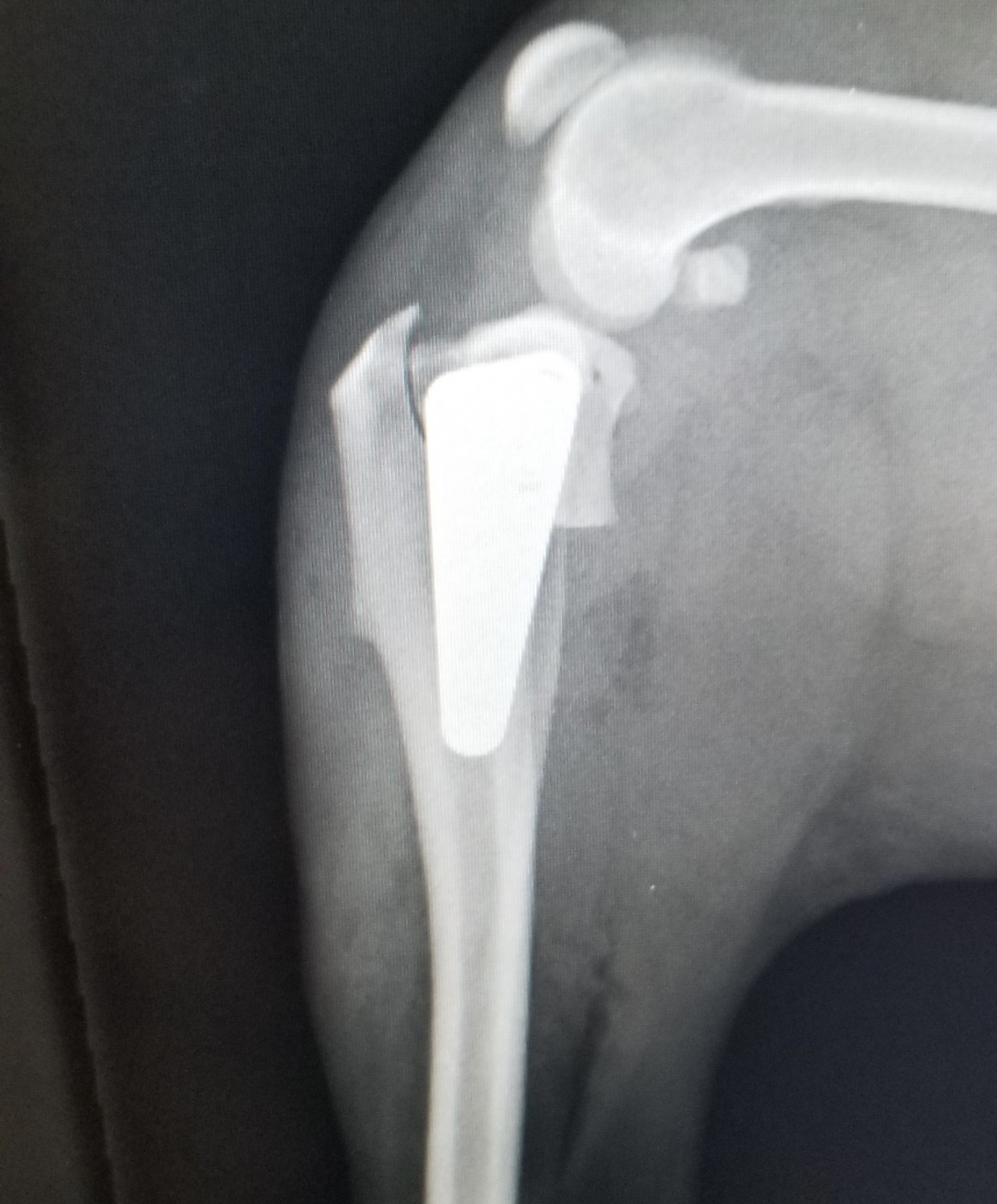 TPLO post-op